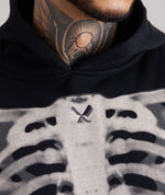 Skeleton
